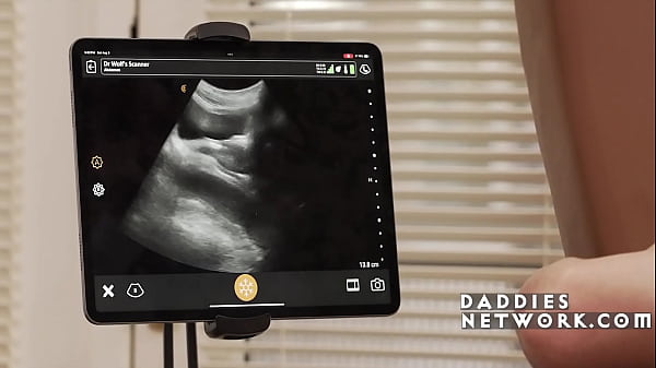 Il cazzo speciale per ultrasuoni anali del dottore#039_s